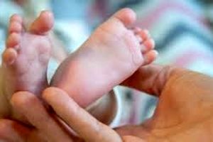 تولد حیرت انگیز دختر عجیب الخلقه/ با خنده هایش دنیا را شیفته خود کرد